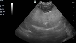 Hepatic Lipidosis in a cat ultrasound karaciğer yağlanması [upl. by Georgina]