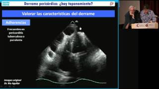 Máster de Técnicos en Ecocardiografía Tutoría 5 [upl. by Yrokcaz350]