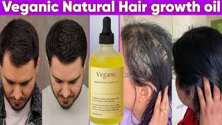 Veganic Natural Hair Regrowth oil Review  How to use  how to buy original [upl. by Leatrice210]