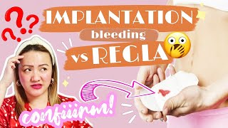 IMPLANTATION BLEEDING VS PERIOD 6 NA PAGKAKAIBA  Nurse Aileen  Tagalog [upl. by Allekim578]