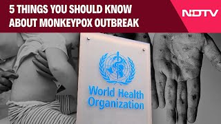 Monkeypox Virus  5 Things You Should Know About MonkeyPox Outbreak [upl. by Dallon]