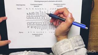 odontograma de signos varinia [upl. by Jezreel]