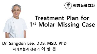 Treatment Plan for 1st Molar Missing Case [upl. by Guadalupe]