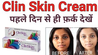 Clin Skin Cream चेहरे को बना देगी गोरा और चमकदार पहले दिन से ही फ़र्क देखें। [upl. by Vergil]