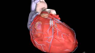 What Is Heart Failure [upl. by Ferrigno]