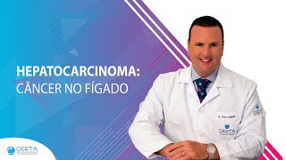 Hepatocarcinoma Câncer no Fígado [upl. by Strephon422]