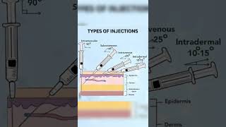 Injection Sites Of Degree  Injection Sites 💉💉📚🩺👨‍⚕️  shortvideo viralreels anatomy reels [upl. by Reivaj]