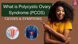 quotWhat is Polycystic Ovary Syndrome PCOS Causes Diagnosis amp Treatmentquot [upl. by Hein]