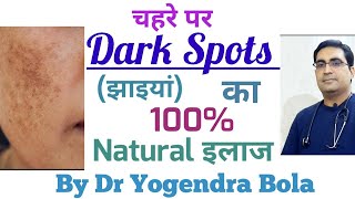 Dark Spots on Face  Melasma  Hyperpigmentation  ka 100  Natural Treatment in hindiby DR Y BOLA [upl. by Petracca]