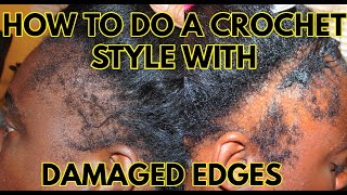 HOW TO INSTALL A CROCHET BRAID STYLE WITH DAMAGED EDGES [upl. by Ariana]