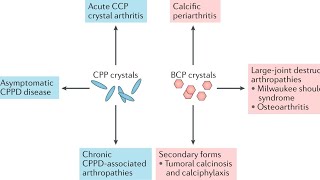 Gout and other Crystal arthropathies [upl. by Amilah]