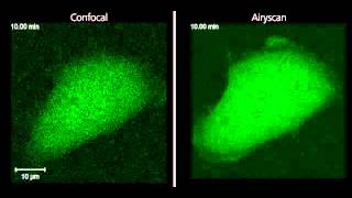 ZEISS LSM 880 Kinetochore movement with Airyscan [upl. by Nyrtak]