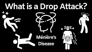 What is a Drop Attack Menieres Disease Drop Attack [upl. by Waechter]