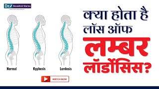 क्या होता है Loss of Lumbar Lordosis Spine Treatment In Noida DelhiNCR amp AgraDr Devashish Sharma [upl. by Lael]