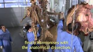 Gunther von Hagens BODY WORLDS Plastination Technique [upl. by Hardy]