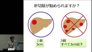 肝臓がん 肝臓がんの外科治療と薬物療法 [upl. by Nnednarb]