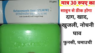 ketoconazoleketoconazole shampooketoconazole soapketoconazole cream [upl. by Allertse264]