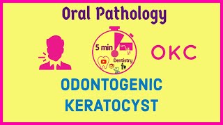 ODONTOGENIC KERATOCYST  OKC  ORAL PATHOLOGY  Exam notes  5mD [upl. by Pascasia]