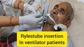 How to Ryles Tube Insertion in Ventilator PatientsRyles Tube Insertion in Critical areaicucare [upl. by Leunamme]