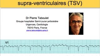 6a Classification des tachycardies supraventriculaires ECG Dr Taboulet [upl. by Berry]