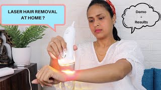 LASER HAIR REMOVAL AT HOME IPL Review amp Results 5 Weeks  Braun Silk Expert 5 [upl. by Gosnell]