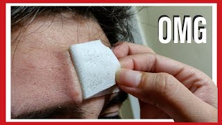 Blackhead asmr removal peel off Forehead Cheeks amp Nose strips ULTRA HIGH QUALITY close up [upl. by Maighdlin367]