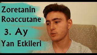 Zoretanin Roaccutane Tedavisi 3 Ay Yan Etkileri  Serkan Tanrıverdi [upl. by Adnorhs]