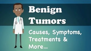 Benign Tumors  Causes Symptoms Treatments amp More… [upl. by Olram646]