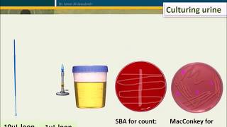 Urine Culture How To Interpret Count [upl. by Siekram]