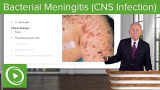 Bacterial Meningitis CNS Infection – Infectious Diseases  Lecturio [upl. by Paddie]