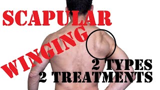 Scapular Winging Fix  Treat Medial And Lateral Winging [upl. by Eloise]