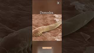 The Shocking Truth About Demodex Mites on Your Skin 🕵️ Shorts [upl. by Radford344]