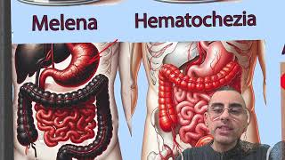 Melena vs Hematochezia Explained symptoms and causes [upl. by Oker]