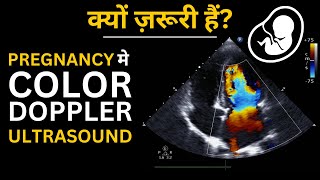 Color Doppler Ultrasound in Pregnancy in Hindi  क्या हैं क्यों करते हैं कैसे करते हैं [upl. by Meehyrb]