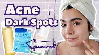 Im Breaking Out Routine for Breakouts and Hyperpigmentation [upl. by Anahsat]