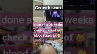 Growth scan in pregnancy pregnancy ultrasound [upl. by Ahnavas]