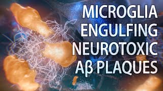 Microglial engulfment of Aβ plaques  Alzheimer’s disease  medical animation [upl. by Freeland709]