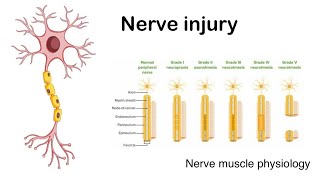 Nerve injury  Sedon and Sunderland classification of nerve injury [upl. by Ryle]