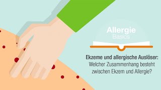 Ekzeme und allergische Auslöser Welcher Zusammenhang besteht zwischen Ekzem und Allergie [upl. by Bowles966]