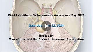 Electrical stapedius reflex testing during vestibular schwannoma resection and cochlear implantation [upl. by Sylvan]