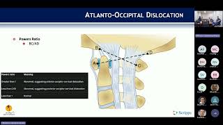 Occipitocervical Trauma  Gautham Prabhakar MD on September 23 2024 [upl. by Hephzipah]