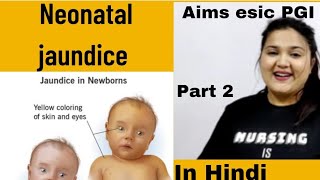 part 2  NEONATAL HYPERBILIRUBINEMIA JAUNDICE MANAGEMENT [upl. by Samalla]