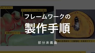 フレームワークの製作手順複印象と耐火模型について [upl. by Allare]