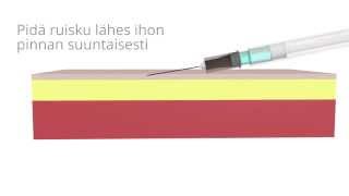 Injektiona annettavan rokotteen antotavat [upl. by Atnes501]