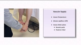 The Diabetic Foot Exam [upl. by Nosnhoj]