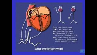 ECG normale er principales anomalies Partie 5 [upl. by Odnavres159]