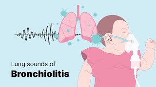 Sounds of Bronchiolitis  Lung Sounds [upl. by Anaujd]