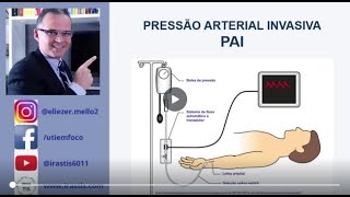 PRESSÃO ARTERIAL INVASIVA  PAI [upl. by Ennavoj]