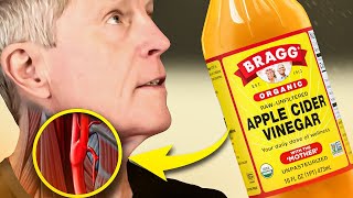 1 Best HIDDEN Benefit of Apple Cider Vinegar [upl. by Fanchan682]