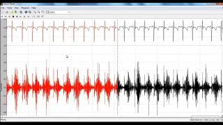 Phonocardiogram Signals Matlab Projects  Phonocardiogram Signals Matlab Thesis [upl. by Orren]